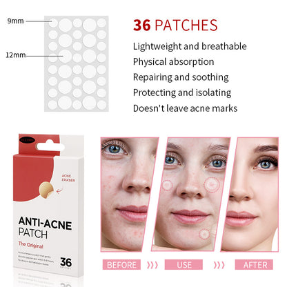 Anti-Acne Patches – The #1 Hydrocolloid Acne Pimple Patch for Shrinking Zits and Whiteheads in 1 use; Nighttime Spot Stickers for Face and Skin (36 Count)
